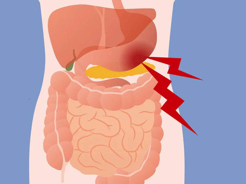 Illustration of Abdominal Pain in the Pancreas Area treatment by Dr. Hari Prasad Yadav who is best abdomen pain doctor in Indore.
