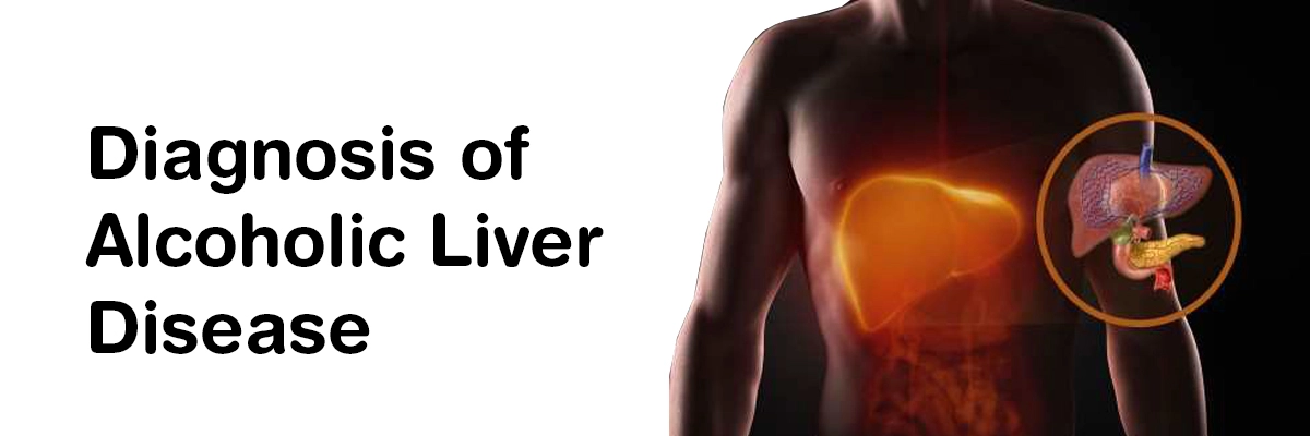 Diagnosis of Alcoholic Liver Disease