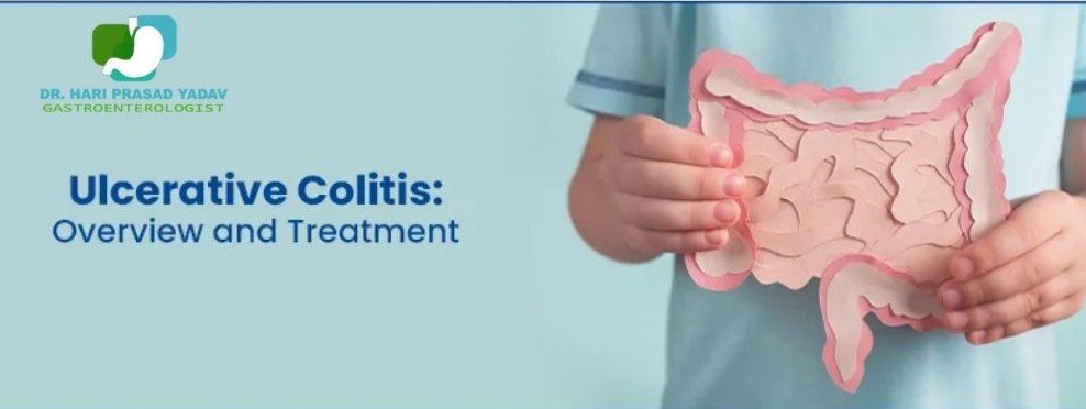 Ulcerative colitis treatment in Indore