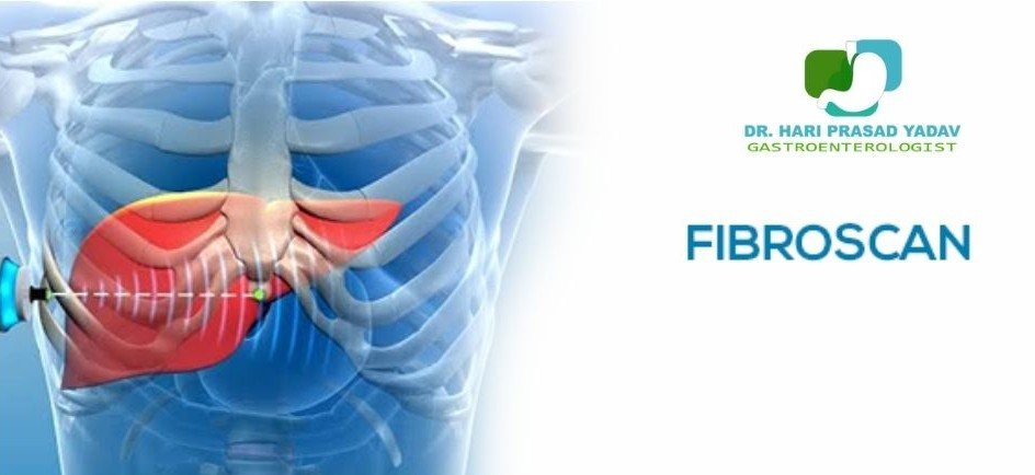 Illustration of Fibroscan treatment in indore procedure on liver